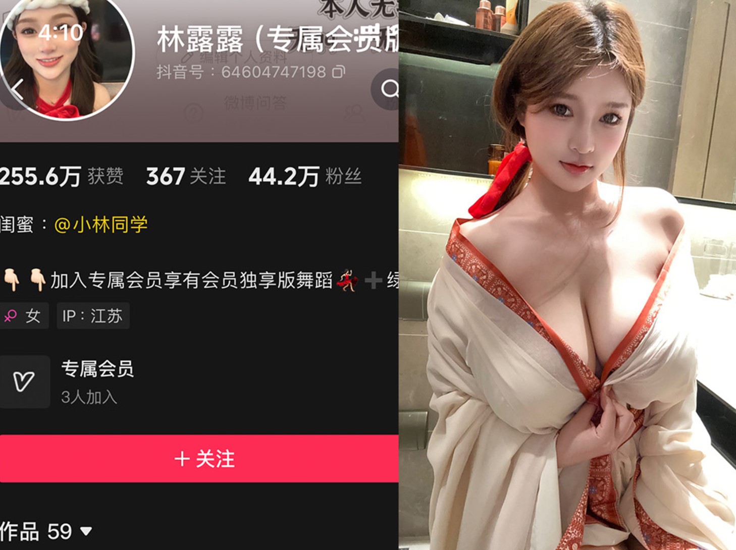 林露露—微密图片视频合集【持续更新】